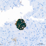 Synaptophysin Antibody in Immunohistochemistry (Paraffin) (IHC (P))