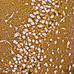 Synaptophysin Antibody in Immunohistochemistry (Paraffin) (IHC (P))