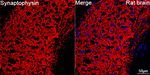 Synaptophysin Antibody in Immunohistochemistry (Paraffin) (IHC (P))