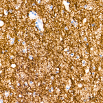 Synaptophysin Antibody in Immunohistochemistry (Paraffin) (IHC (P))