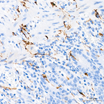 Synaptophysin Antibody in Immunohistochemistry (Paraffin) (IHC (P))