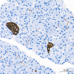 Synaptophysin Antibody in Immunohistochemistry (Paraffin) (IHC (P))