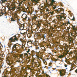 Synaptophysin Antibody in Immunohistochemistry (Paraffin) (IHC (P))