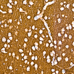 Synaptophysin Antibody in Immunohistochemistry (Paraffin) (IHC (P))