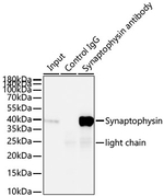 Synaptophysin Antibody in Immunoprecipitation (IP)