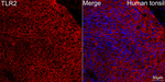 TLR2 Antibody in Immunohistochemistry (Paraffin) (IHC (P))