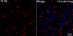 TLR2 Antibody in Immunohistochemistry (Paraffin) (IHC (P))