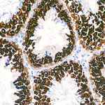 BOLL Antibody in Immunohistochemistry (Paraffin) (IHC (P))
