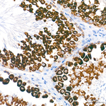 BOLL Antibody in Immunohistochemistry (Paraffin) (IHC (P))