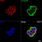 PERK Antibody in Immunocytochemistry (ICC/IF)
