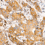 PERK Antibody in Immunohistochemistry (Paraffin) (IHC (P))