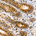 PERK Antibody in Immunohistochemistry (Paraffin) (IHC (P))