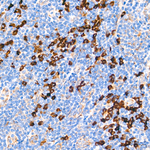 PERK Antibody in Immunohistochemistry (Paraffin) (IHC (P))