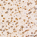 PERK Antibody in Immunohistochemistry (Paraffin) (IHC (P))