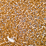 PERK Antibody in Immunohistochemistry (Paraffin) (IHC (P))