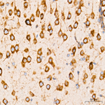 PERK Antibody in Immunohistochemistry (Paraffin) (IHC (P))