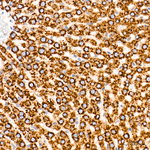 PERK Antibody in Immunohistochemistry (Paraffin) (IHC (P))