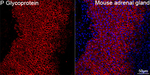 ABCB1 Antibody in Immunohistochemistry (Paraffin) (IHC (P))