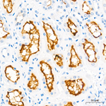 ABCB1 Antibody in Immunohistochemistry (Paraffin) (IHC (P))