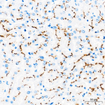 ABCB1 Antibody in Immunohistochemistry (Paraffin) (IHC (P))