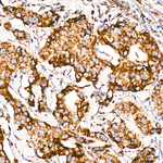 MT-ATP8 Recombinant Rabbit Monoclonal Antibody (1P1U1)