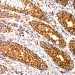 MT-ATP8 Antibody in Immunohistochemistry (Paraffin) (IHC (P))