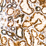 MT-ATP8 Antibody in Immunohistochemistry (Paraffin) (IHC (P))