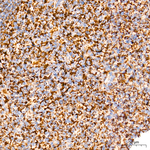 MT-ATP8 Antibody in Immunohistochemistry (Paraffin) (IHC (P))