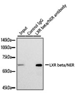 LXR beta Antibody in Immunoprecipitation (IP)