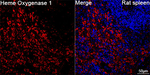 HO-1 Antibody in Immunohistochemistry (Paraffin) (IHC (P))