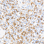 HO-1 Antibody in Immunohistochemistry (Paraffin) (IHC (P))