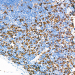 HO-1 Antibody in Immunohistochemistry (Paraffin) (IHC (P))
