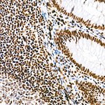 PML Antibody in Immunohistochemistry (Paraffin) (IHC (P))