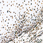 PML Antibody in Immunohistochemistry (Paraffin) (IHC (P))
