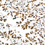 PML Antibody in Immunohistochemistry (Paraffin) (IHC (P))
