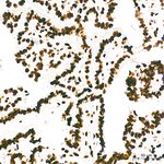 PML Antibody in Immunohistochemistry (Paraffin) (IHC (P))