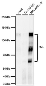 PML Antibody in Immunoprecipitation (IP)