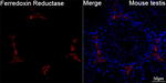 FDXR Antibody in Immunohistochemistry (Paraffin) (IHC (P))