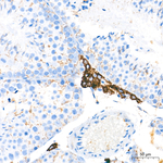 FDXR Antibody in Immunohistochemistry (Paraffin) (IHC (P))