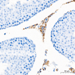 FDXR Antibody in Immunohistochemistry (Paraffin) (IHC (P))