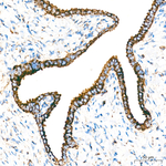 FDXR Antibody in Immunohistochemistry (Paraffin) (IHC (P))