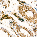 FDXR Antibody in Immunohistochemistry (Paraffin) (IHC (P))