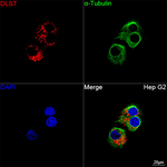 DLST Recombinant Rabbit Monoclonal Antibody (3Z9S9)