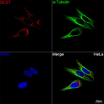 DLST Antibody in Immunocytochemistry (ICC/IF)