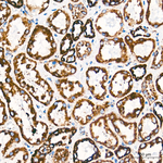 DLST Antibody in Immunohistochemistry (Paraffin) (IHC (P))