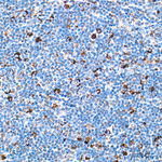 DLST Antibody in Immunohistochemistry (Paraffin) (IHC (P))