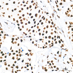 ATF1 Antibody in Immunohistochemistry (Paraffin) (IHC (P))