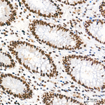 ATF1 Antibody in Immunohistochemistry (Paraffin) (IHC (P))