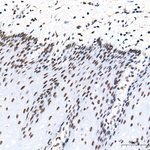 ATF1 Antibody in Immunohistochemistry (Paraffin) (IHC (P))