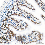 ATF1 Antibody in Immunohistochemistry (Paraffin) (IHC (P))